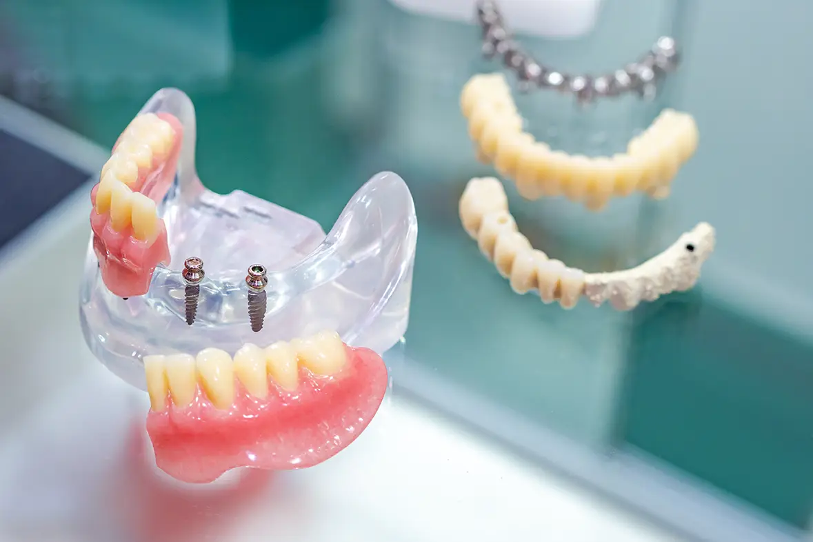 Dentnet KBF Protetik